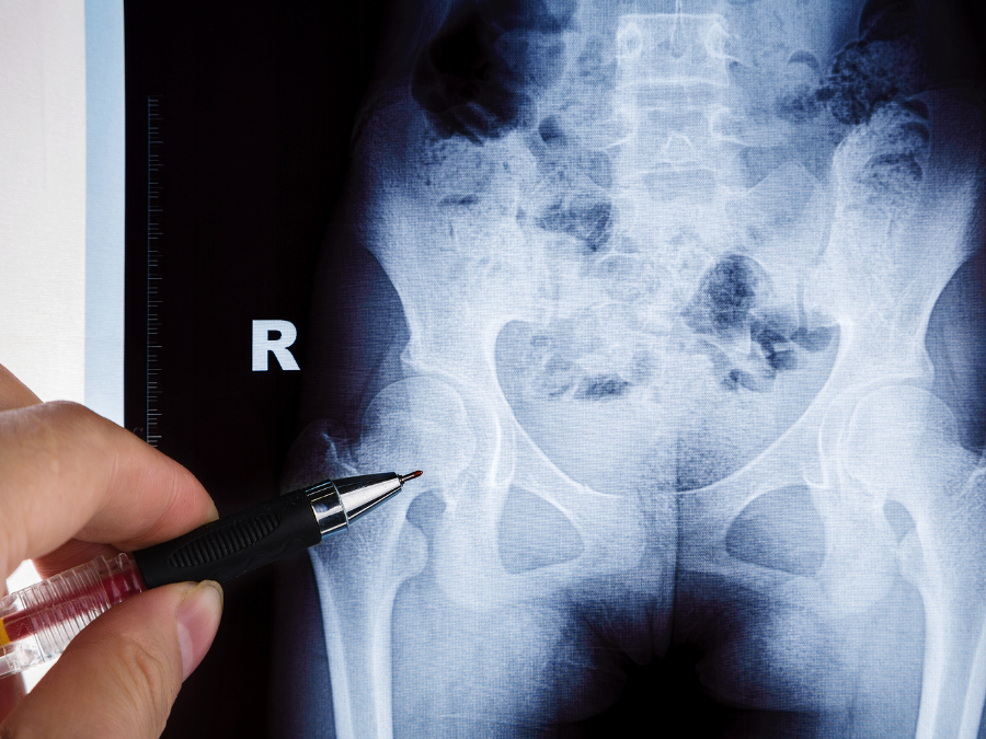 Medico che esamina un paziente con dolore all'anca durante una visita.